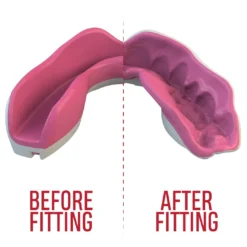 SAFEJAWZ® EXTRO SERIES SELF-FIT 'PINK FANGZ' MOUTHGUARD